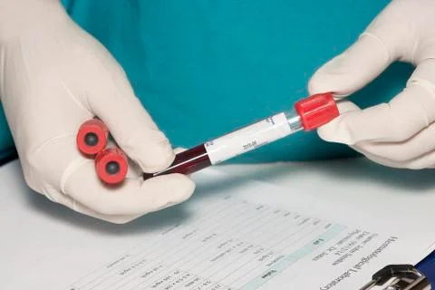 Blood test Stock Photos