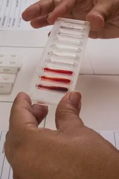Blood test Stock Photos