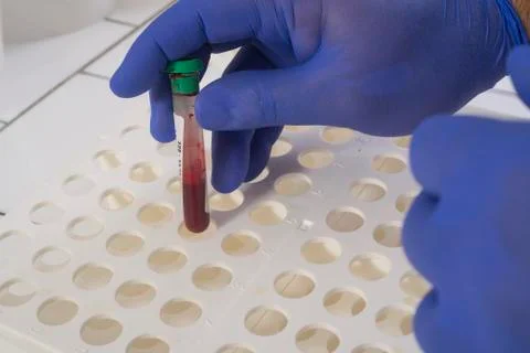 Blood test Stock Photos