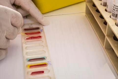 Blood test Stock Photos
