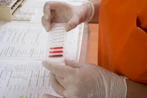 Blood test Stock Photos