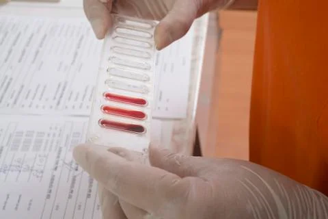 Blood test Stock Photos