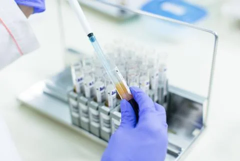 Blood test Stock Photos