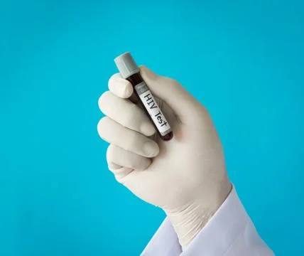 Blood test Stock Photos
