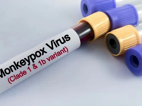 Blood test sample for monkey pox virus (MPXV) test. Stock Footage 292408709