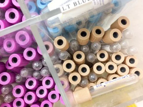 Blood test sample vials Foto stock