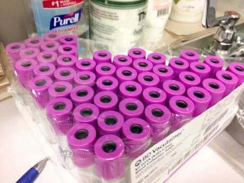Blood test sample vials Foto stock