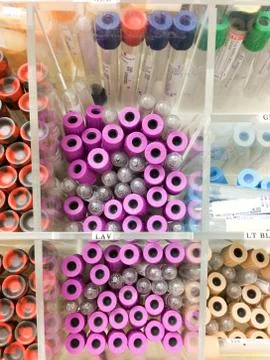 Blood test sample vials Foto stock