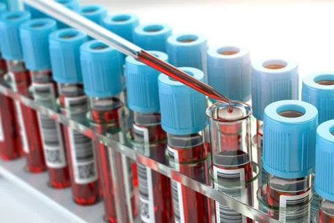 Blood test samples tubes and blood test pipette adding fluid to one of tub... Fotos Stock