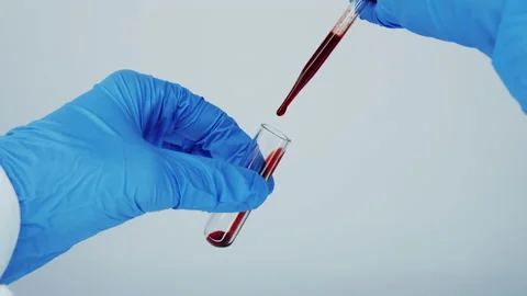 Blood test in test tube. Stock Footage 149175689