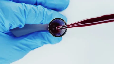 Blood test in test tube. Stock Footage 149176024
