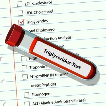 Blood Test for Triglycerides Analysis Stock Illustration