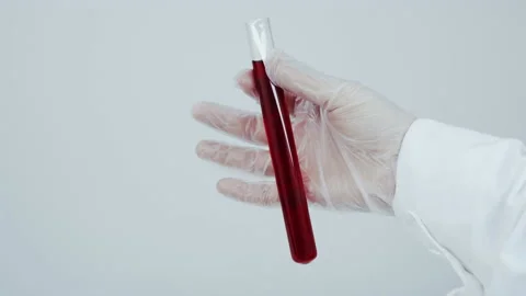 Blood in a test tube. Stock Footage 148721650