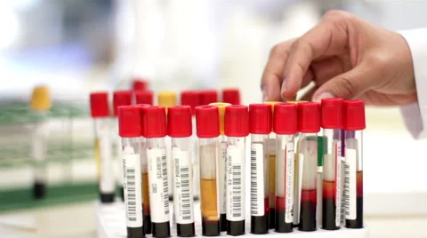 Blood test tubes being analyzed and interchanged by a laboratory worker.CLOSE UP Stock Footage 40977839