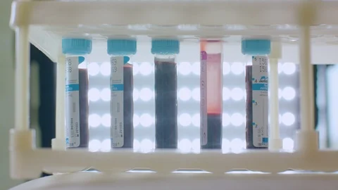 Blood test tubes in laboratory Stock Footage 112210088