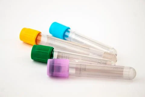 Blood test tubes Stock Photos