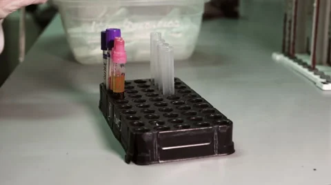 Blood testing and analysis at modern medical laboratory Stock Footage 59512930