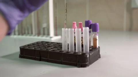 Blood testing and analysis at modern medical laboratory Stock Footage 59515367