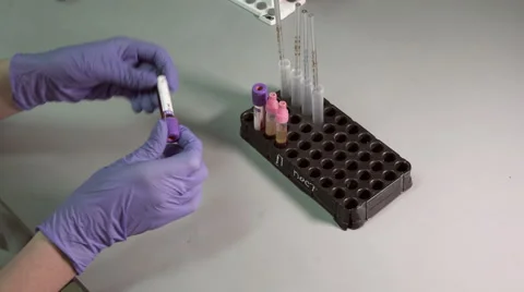 Blood testing and analysis at modern medical laboratory Stock Footage 59515562