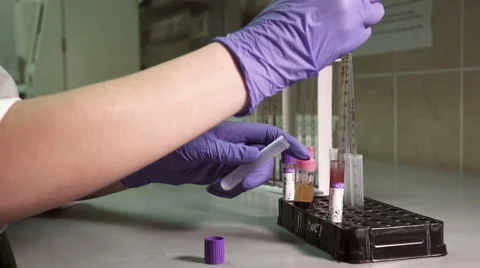 Blood testing and analysis at modern medical laboratory Stock Footage 59515946