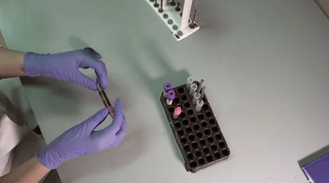 Blood testing and analysis at modern medical laboratory Stock Footage 59516155