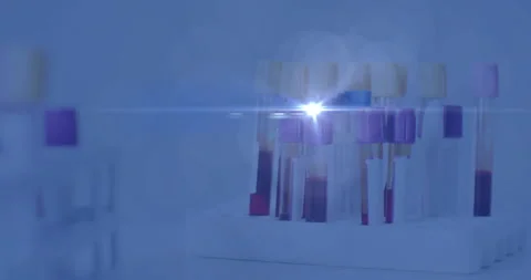 Blood testing concept showing white rack holding colored sample tubes in 3D Video stock 308676335