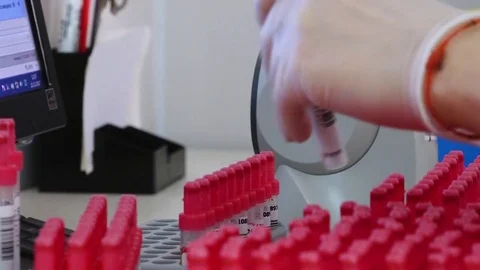Blood Testing Laboratory 库存影片 83722575