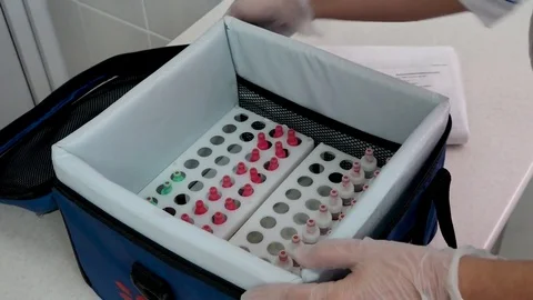 Blood Testing Laboratory 動画素材 83727762