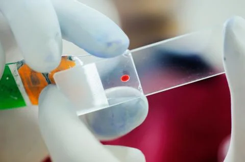 Blood testing in laboratory Foto stock