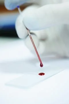 Blood testing in laboratory Stock Photos