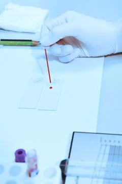 Blood testing in laboratory Stock Photos