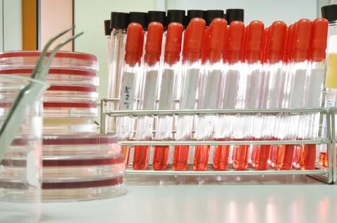 Blood testing in laboratory  Stock Photos