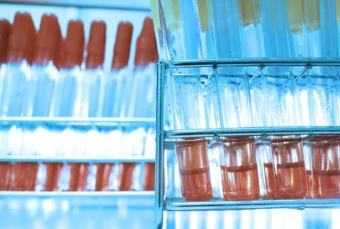 Blood testing in laboratory Stock Photos