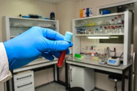 Blood testing in the laboratory. Stock Photos