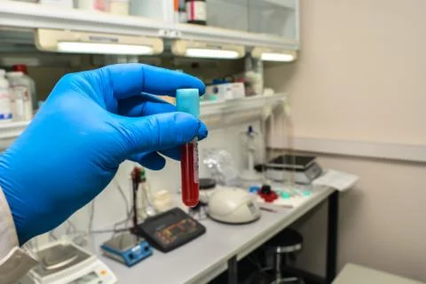Blood testing in the laboratory. Stock Photos