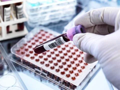 Blood testing Stock Photos