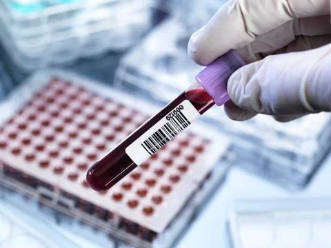 Blood testing Foto stock