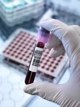 Blood testing 写真素材