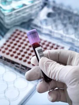 Blood testing Stock Photos