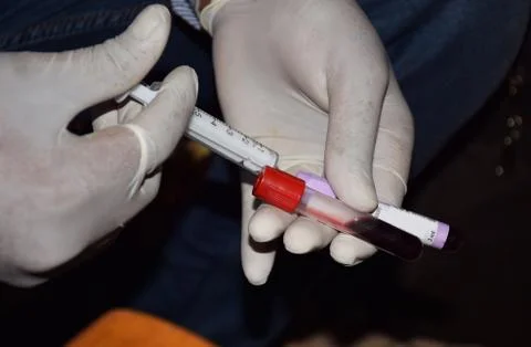 Blood Testing Process Stock Photos