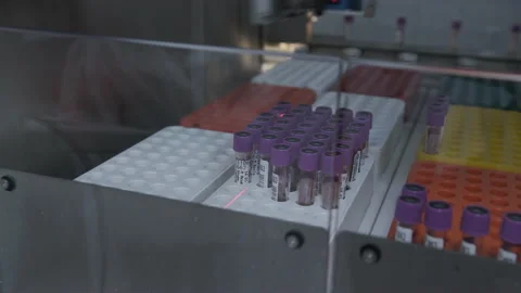 Blood tests, automatic line. COVID-19. Stock-Footage 148192852