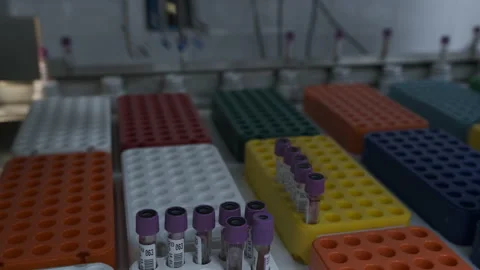 Blood tests, automatic line. COVID-19. Close up Stock Footage