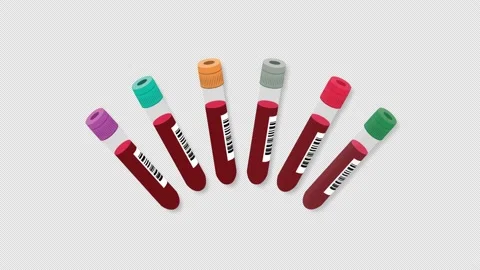 Blood tests Stock Footage 168620761