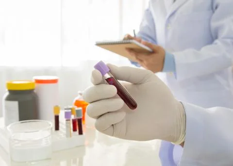 Blood tests Stock Photos