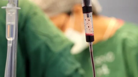 Blood transfusion 库存影片 8688411