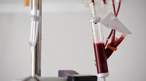 Blood Transfusion Stock Footage 52654385
