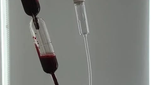 Blood Transfusion Stock Footage 279523823
