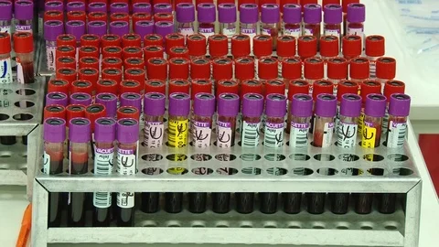 Blood tubes Stock Footage
