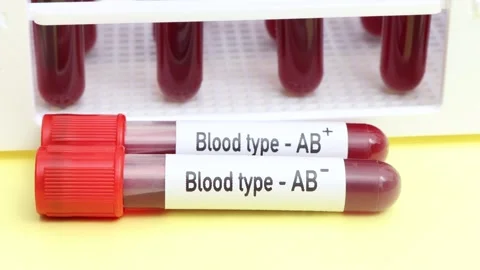 Blood Type AB Rh Positive And Negative T... | Stock Video | Pond5