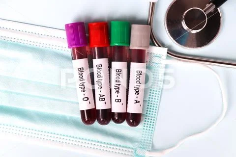 Blood type Rh negative test, blood sample to analyze in the laboratory ...